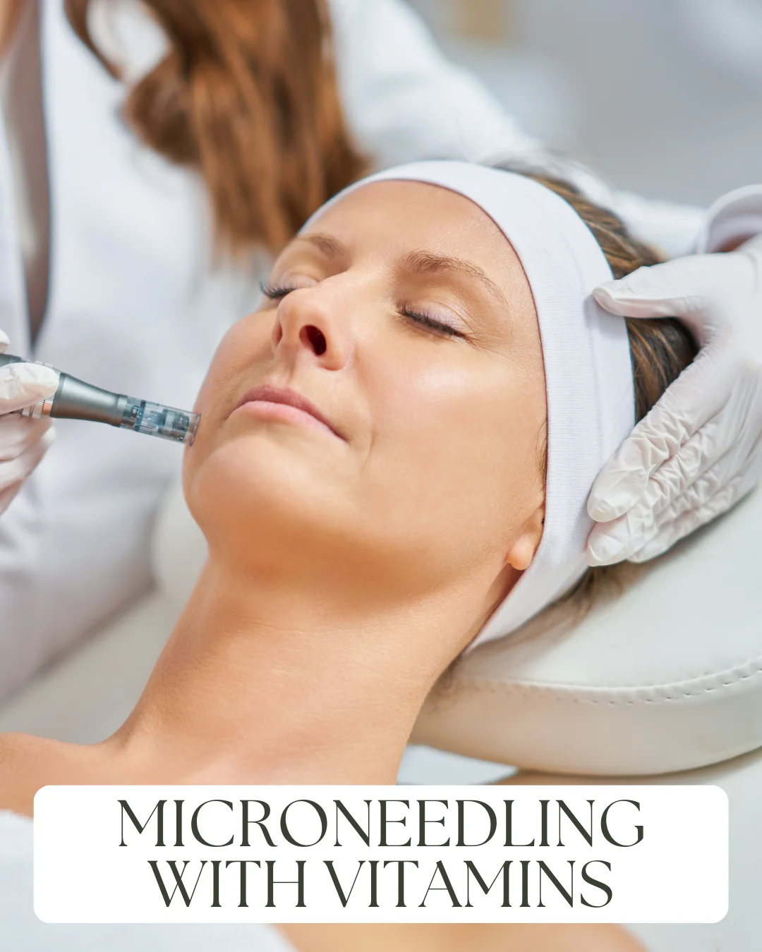 10. Microneedling with Vitamins