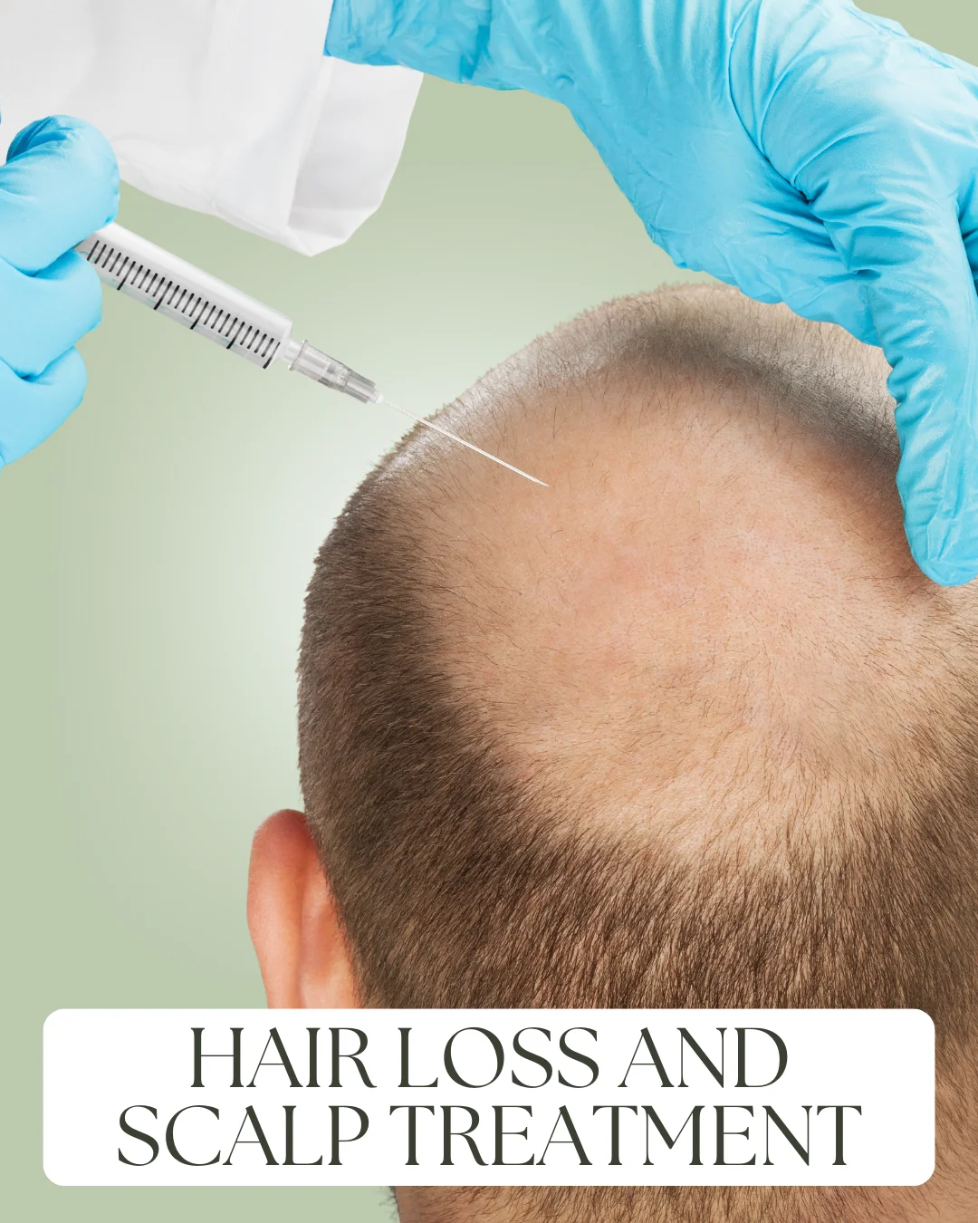 HAIR LOSS AND SCALP TREATMENT